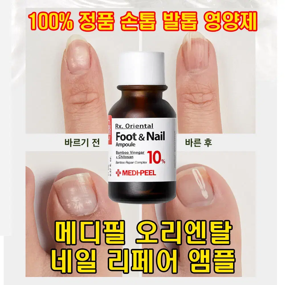 새상품) 메디필 네일 목초 앰플 손톱 발톱 영양제 각질케어